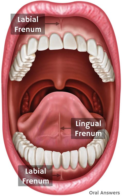 labial frenum vs frenotomy.